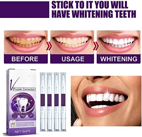 4 PCS ljubičasta olovka za pastu za zube s mekom četkicom Uklanjanje mrlje od mrlja nježno izbjeljivanje zuba zuba Zubi zuba